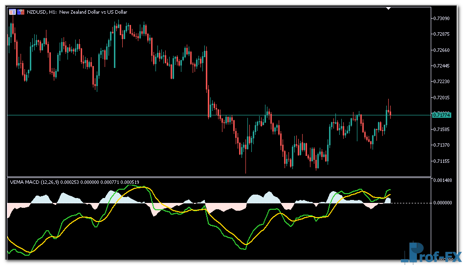 VEMA MACD mt5 indicator